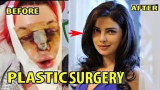 SHOCKING Plastic Surgery of Bollywood Actresses BEFORE & AFTER | Katrina , Anushka, Aysha ,Priyanka