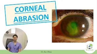 What is a Corneal Abrasion? What is a Corneal Scratch? I Dr Shaz Rehan, 2020