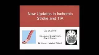 New Updates in Ischemic Stroke and TIA