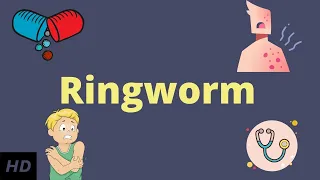 Ringworm, Causes, Signs and Symptoms, Diagnosis and Treatment.