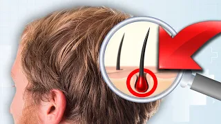 What Actually Causes Hair Loss? (Primary vs. Secondary Factors)