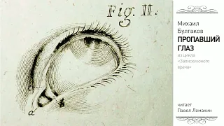 М.Булгаков. Пропавший глаз (из цикла "Записки юного врача")