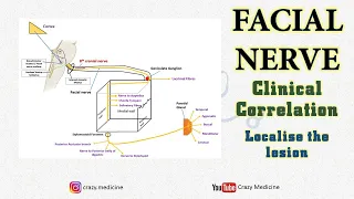 Facial Nerve | Clinical Co-relation | Lesion Localisation |