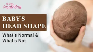 Baby's Head Shape - What's Normal and What's Not?