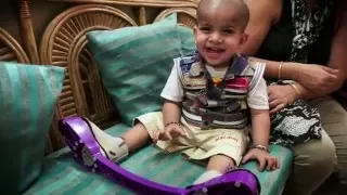 Treating Every Child with Clubfoot (Full Feature)