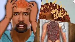 ASMR _ Worms on man's bald head of treatment _ Treatment of eight on the back of a man _ animation