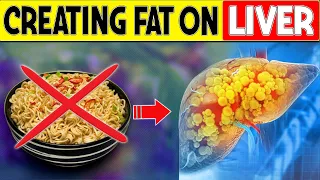 Top 15 Foods That Create FAT ON YOUR LIVER You Are Likely Ignoring