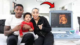 SEEING OUR BABY'S FACE FOR THE FIRST TIME!!**Emotional**