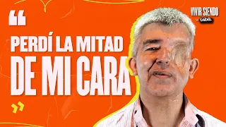 VIVIR CON MEDIO ROSTRO: “Todo empezó con un LUNAR” (x @estoestabu)