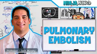 Pulmonary Embolism | Etiology, Pathophysiology, Clinical Features, Diagnosis, Treatment