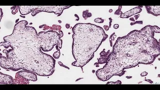Histology of the Placenta 4K