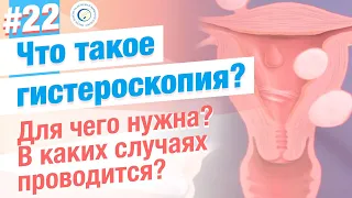 Что такое гистероскопия? Чем хороша гистероскопия?