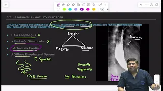 INI-CET May 2024|| Surgery Recall ||Dr.Saurabh Dixit ||Important add on concepts for NEET PG 2024