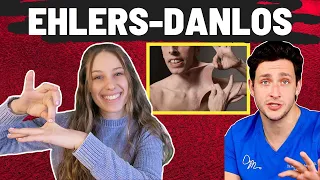 EDS Patient Reacts to Doctor Mike | Ehlers Danlos syndrome