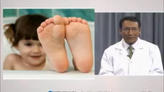 Anomalías más frecuentes en los pies de los niños