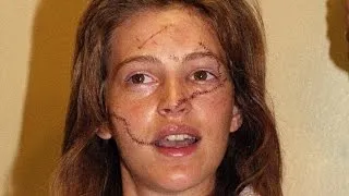 Former Model Who Was Slashed 30 Years Ago is Trying to Help Other Victims