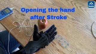 How to practice opening the hand after a neurological injury, e.g stroke