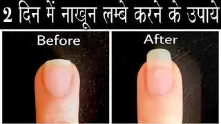 नाखूनों को लम्बे मजबूत और सुंदर बनाने के रामबाण उपाय || Strong Nail Growth Tips in Hindi