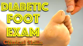 Diabetic Foot Examination - Clinical Skills - Dr Gill