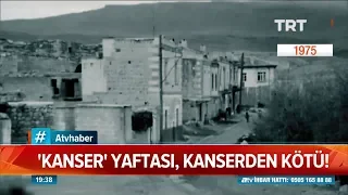 Kanser yaftası kanserden kötü! - Atv Haber 2 Ekim 2019