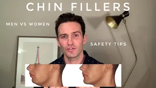 Chin fillers: A guide for a proportionate lower face.