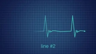 EKG Heart Monitor Flatline After Effects Templates