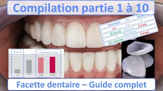 Facette dentaire - Guide complet - Compilation partie 1 à 10