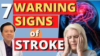 7 Warning Signs of Stroke - by Doc Willie Ong