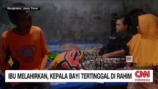 Ibu Melahirkan, Kepala Bayi Tertinggal di Rahim