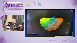 Ищенко Роман Викторович - Инновации в лечении опухолей печени