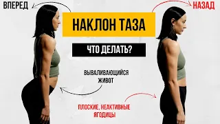 НАКЛОН ТАЗА. Как исправить наклон таза. Плоские ягодицы/Вываливающийся живот.