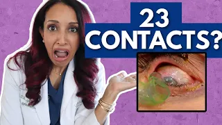 Eye Doctor Reacts to 23 Contacts In the Eye
