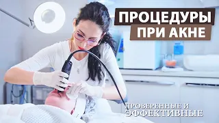 Проверенные процедуры при акне