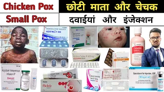 Chiken Pox | Small Pox | Antiviral Medicine | Pharmacy | B pharmacy | D pharmacy | Treatment | दवाई