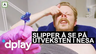 Jan Thomas og Einar blir venner | Einar får fjernet nesehåret | discovery+ Norge