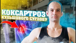 ВПРАВИ ПРИ КОКСАРТРОЗІ КУЛЬШОВОГО СУГЛОБА / АРТРОЗ КУЛЬШОВОГО СУГЛОБА / ВПРАВИ ДЛЯ СУГЛОБІВ