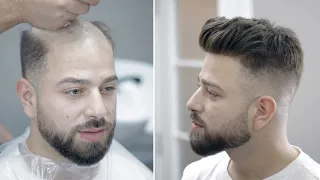 PROTEZ SAÇ - Hair Replacement