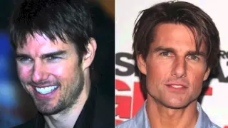 Tom Cruise Before and After Plastic Surgery Photos