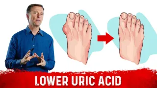 4 Ways  to Neutralize Uric Acid