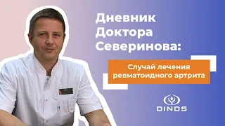 Доктор Северинов: Случай лечения ревматоидного артрита