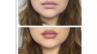 Kylie Jenner Lips/ Usta Kylie Jenner