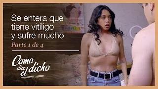 Como dice el dicho 1/4: Su novio la rechaza por tener manchas en el cuerpo | Es bien hermosa...