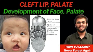 Development of Palate, Face | Embryology | Cleft Lip, Cleft Palate Video Human Embryology