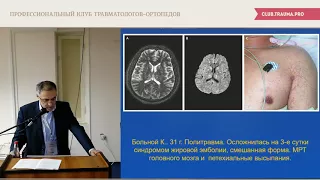 Новый способ профилактики жировой эмболии у больных с политравмой.