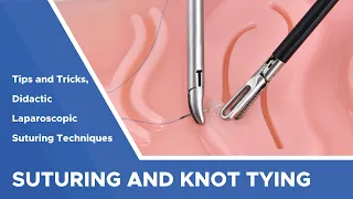 Tips and Tricks for Laparoscopic Suturing and Knot Tying: Advancing Your Skills (Didactic)