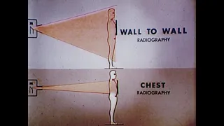 X-rays...How safe!! (University of Illinois, 1974)