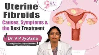 Signs and Symptoms of Fibroids in Uterus || Dr. VP Jyotsna || 9M Hospitals