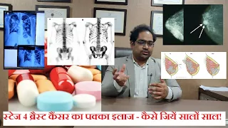 Stage 4 breast cancer treatment - last stage breast cancer survival in hindi 2021