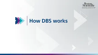 How Deep Brain Stimulation (DBS) Therapy Works