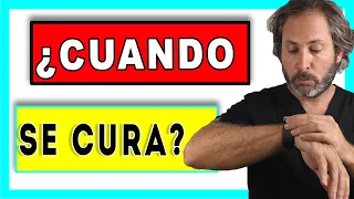 ¿Cuánto tiempo⏳tarda en 𝗖𝗜𝗖𝗔𝗧𝗥𝗜𝗭𝗔𝗥 una EXTRACCION MUELA? Tiempo de  RECUPERACION 𝙈𝙐𝙀𝙇𝘼 𝘿𝙀𝙇 𝙅𝙐𝙄𝘾𝙄𝙊 💪